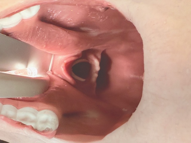 Räddningsdocka Pro Elite - Bild 3